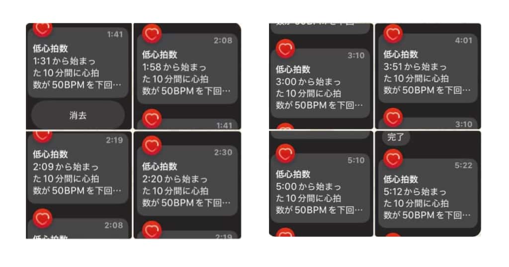 Apple Watch睡眠レポートの心拍50台表示